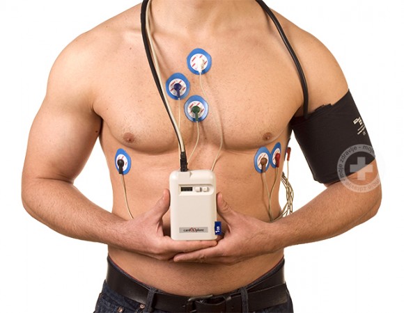 Najčešća pitanja i odgovori o holteru tlaka i EKG-a